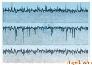 一文看懂表面粗糙度 Ra Rz Rp Rq Rt Rsk 一文看懂表面粗糙度 Ra Rz Rp Rq Rt Rsk